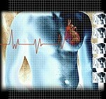 los-dispositivos-cardiacos-implantados-tienen-beneficios-en-el-mundo-real-segun-un-estudio.jpg