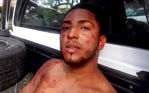 Hombre agrede a machetazos a sus padres en Gurabo
