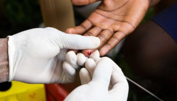 prueba VIH
